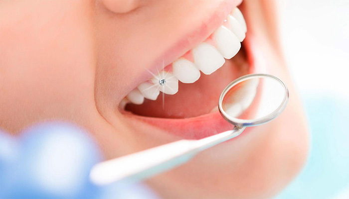 3 τρόποι για να αποτρέψετε τη φθορά στα δόντια σας